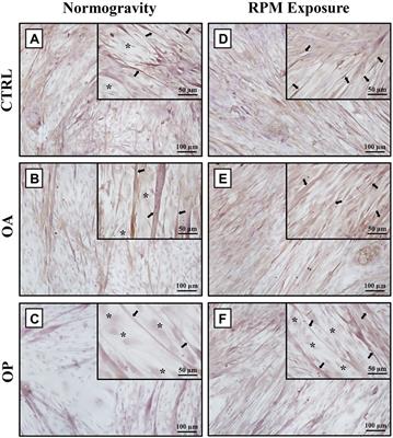 Role of Myostatin in Muscle Degeneration by Random Positioning Machine Exposure: An in vitro Study for the Treatment of Sarcopenia